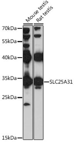 Western blot - SLC25A31 antibody (A16577)