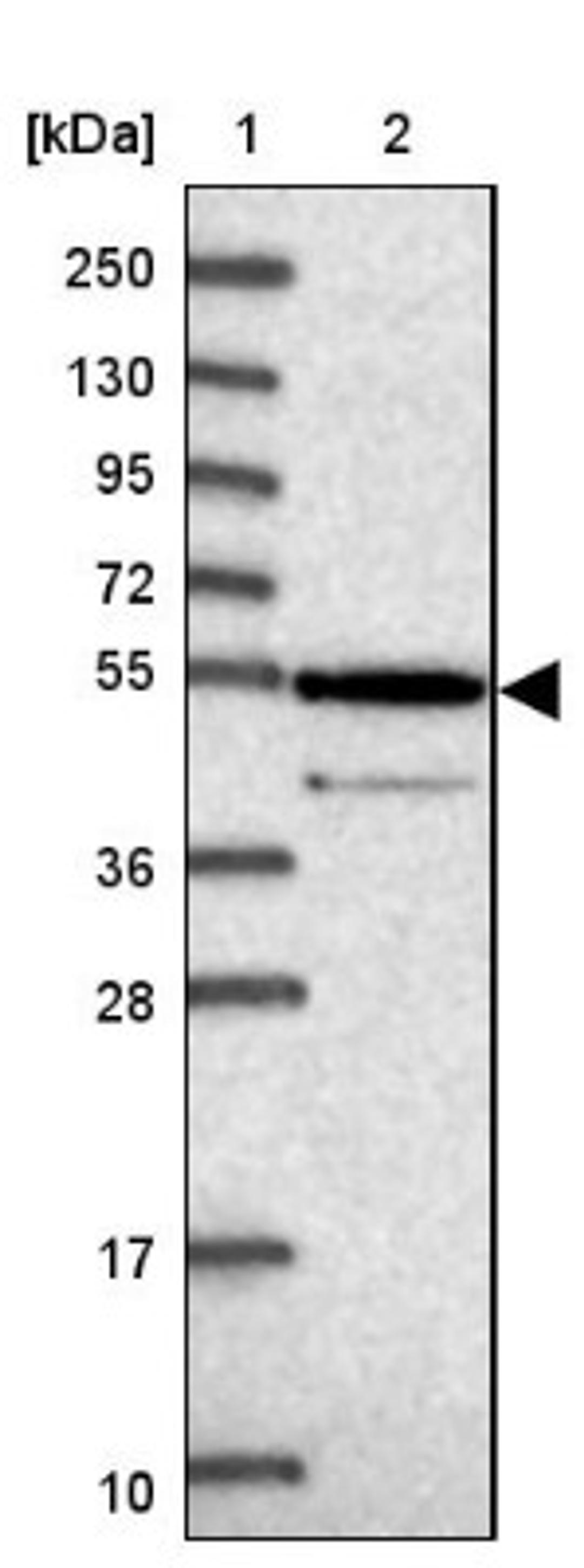 Western Blot: ZNF565 Antibody [NBP1-81951] - Lane 1: Marker [kDa] 250, 130, 95, 72, 55, 36, 28, 17, 10<br/>Lane 2: Human cell line RT-4