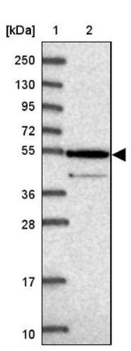 Western Blot: ZNF565 Antibody [NBP1-81951] - Lane 1: Marker [kDa] 250, 130, 95, 72, 55, 36, 28, 17, 10<br/>Lane 2: Human cell line RT-4