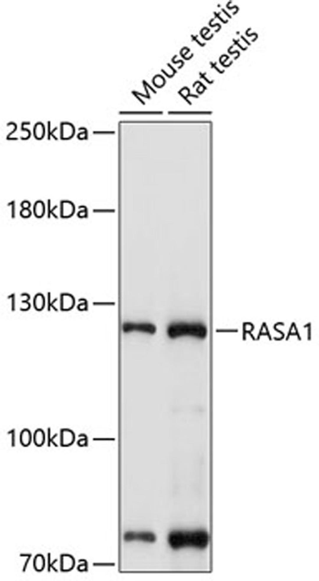 Western blot - RASA1 antibody (A1634)