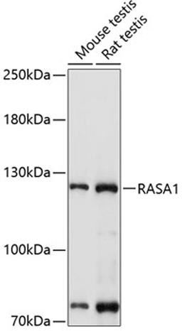 Western blot - RASA1 antibody (A1634)