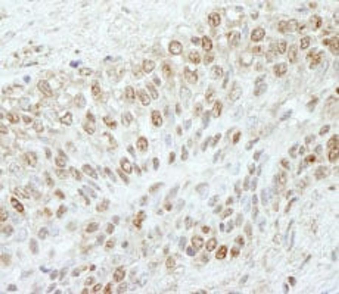 Detection of human WDR91 by immunohistochemistry.