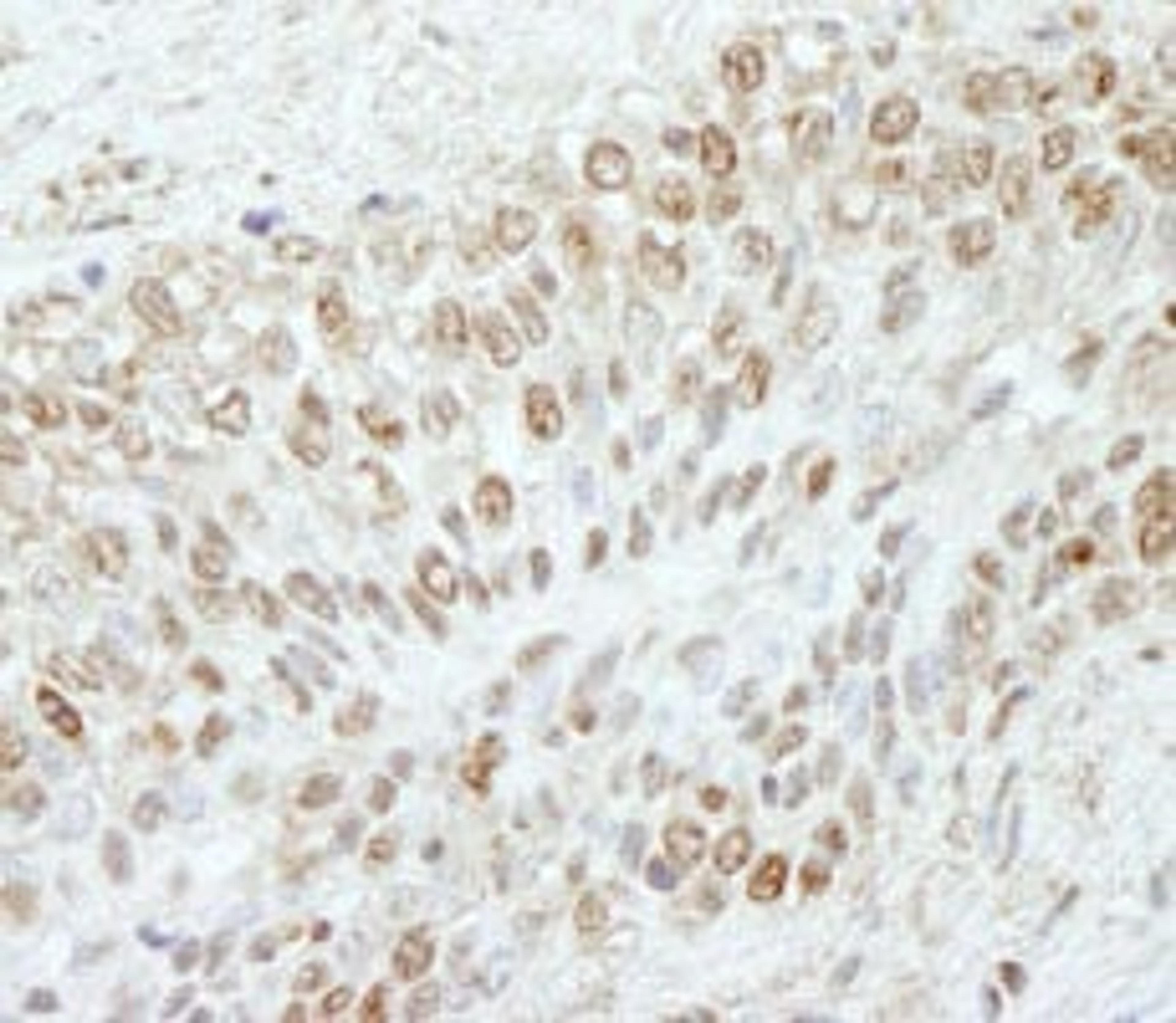 Detection of human WDR91 by immunohistochemistry.