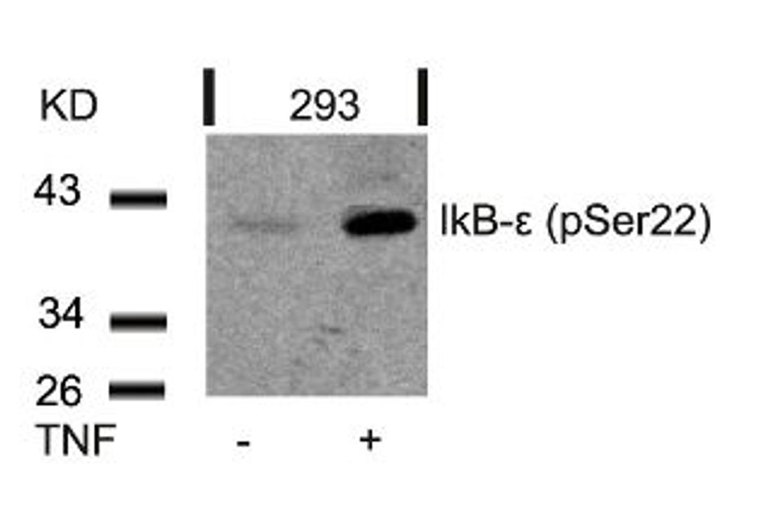 Western blot analysis of lysed extracts from 293 cells untreated or treated with TNF using IkB-&#949; (Phospho-Ser22).