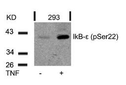 Western blot analysis of lysed extracts from 293 cells untreated or treated with TNF using IkB-&#949; (Phospho-Ser22).