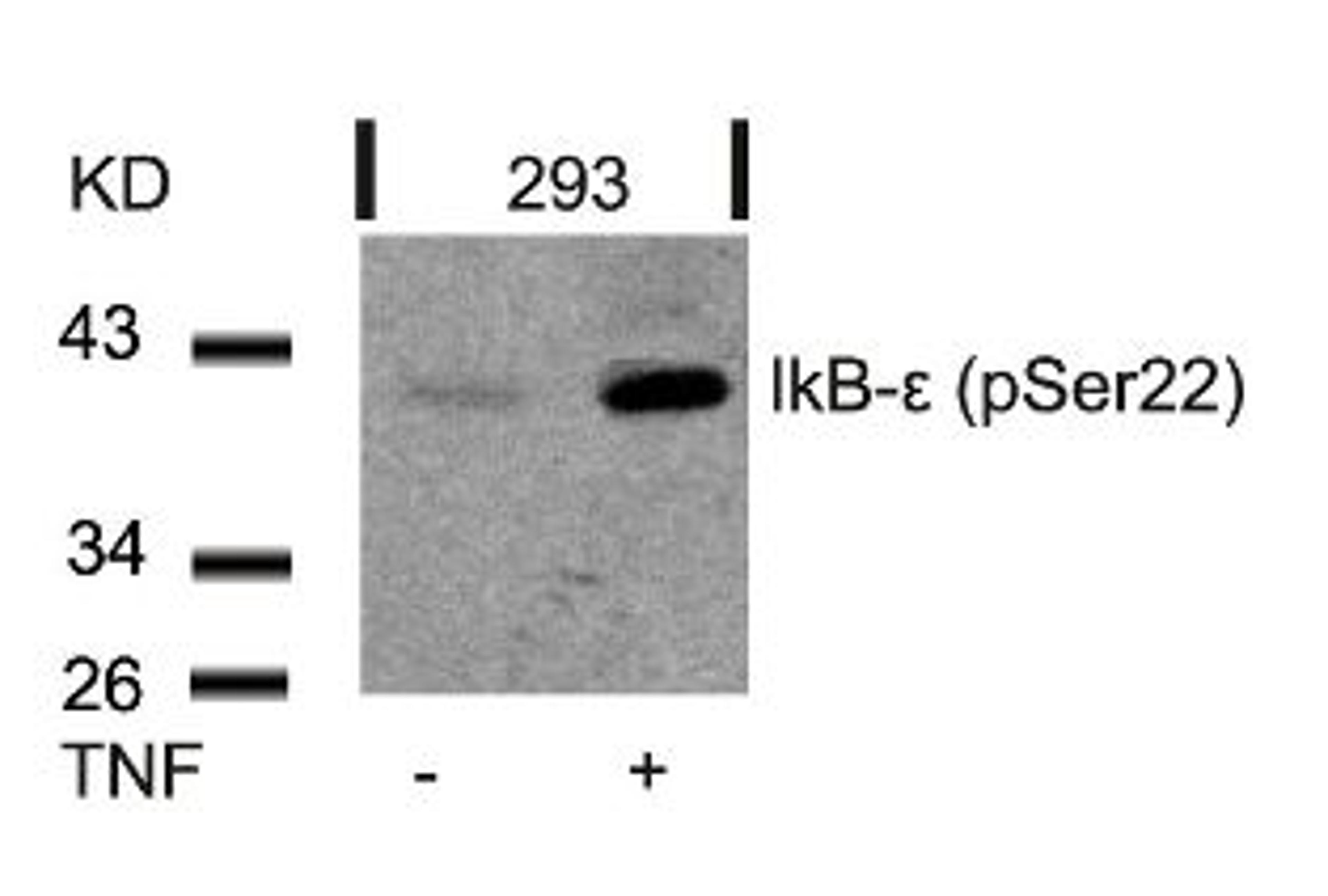 Western blot analysis of lysed extracts from 293 cells untreated or treated with TNF using IkB-&#949; (Phospho-Ser22).