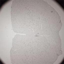 Immunohistochemistry-Paraffin: Vesicular Acetylcholine Transporter Antibody [NB100-91348] - IHC on rat spinal cord (paraffin section) using Rabbit antibody to (Vesicular Acetylcholine Transporter) VACHT: whole serum at 1 : 200 dilution incubated overnight at 4C, developed with DAB/Ni and counterstained with hematoxylin.