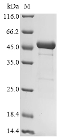 (Tris-Glycine gel) Discontinuous SDS-PAGE (reduced) with 5% enrichment gel and 15% separation gel.