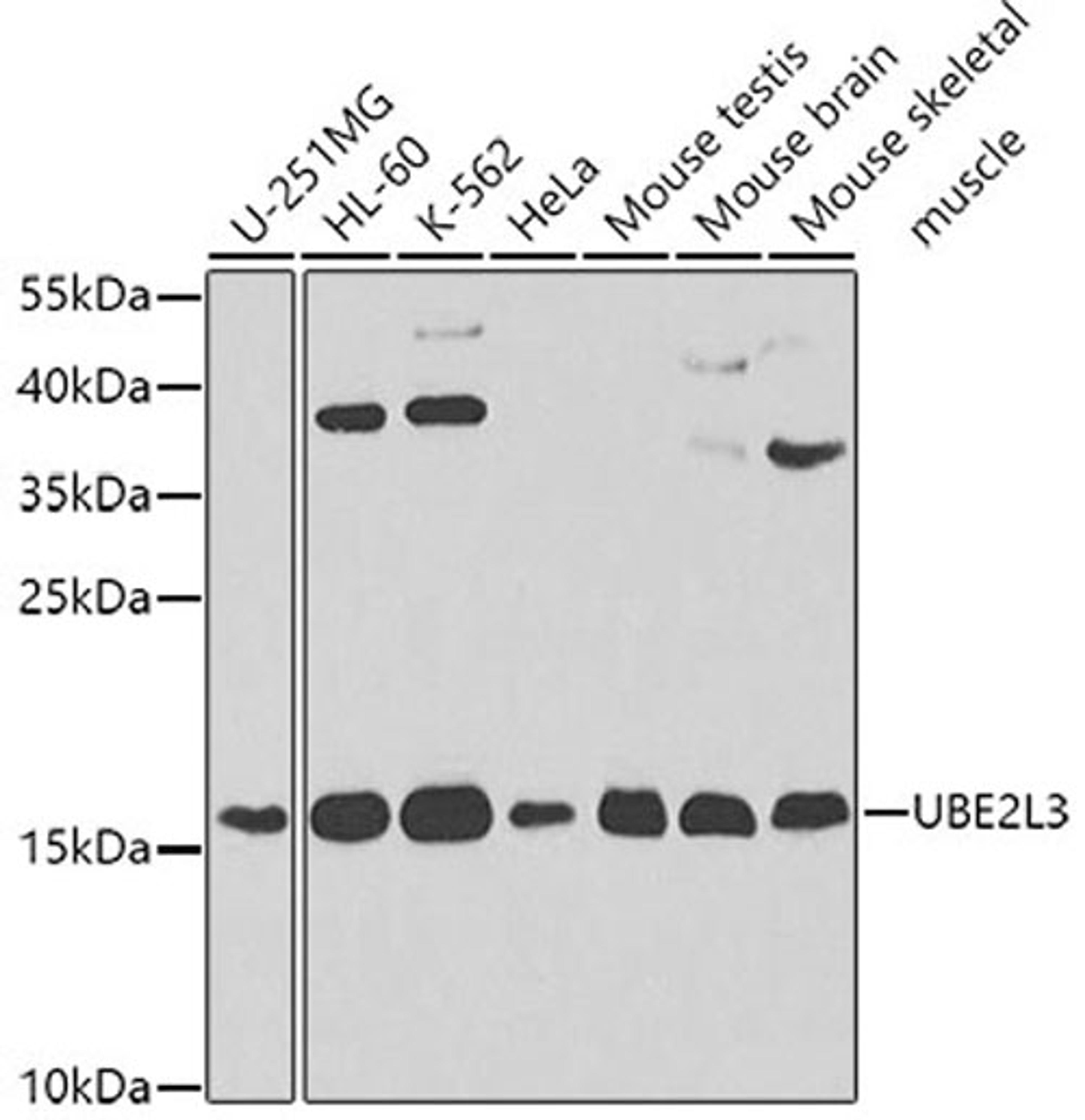 Western blot - UBE2L3 antibody (A4175)