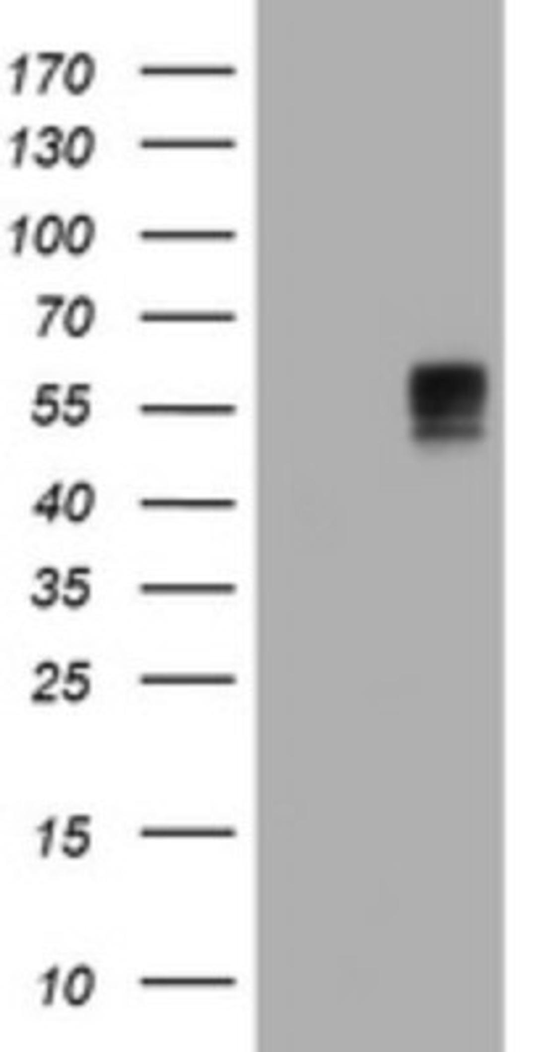 Western Blot: BTLA/CD272 Antibody (2E4) [NBP2-45549] - Analysis of HEK293T cells were transfected with the pCMV6-ENTRY control (Left lane) or pCMV6-ENTRY BTLA.