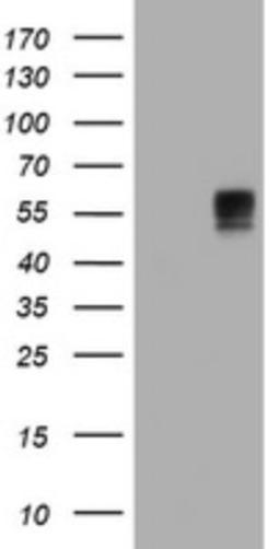 Western Blot: BTLA/CD272 Antibody (2E4) [NBP2-45549] - Analysis of HEK293T cells were transfected with the pCMV6-ENTRY control (Left lane) or pCMV6-ENTRY BTLA.