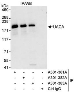 Detection of human UACA by western blot of immunoprecipitates.