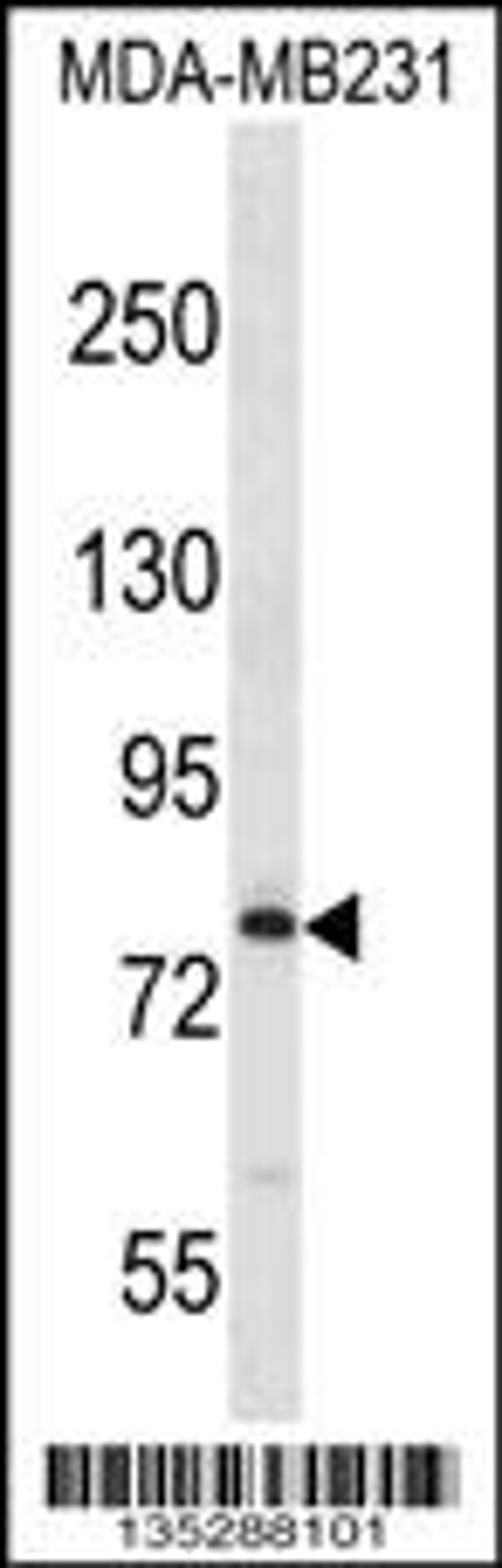 Western blot analysis in MDA-MB231 cell line lysates (35ug/lane).