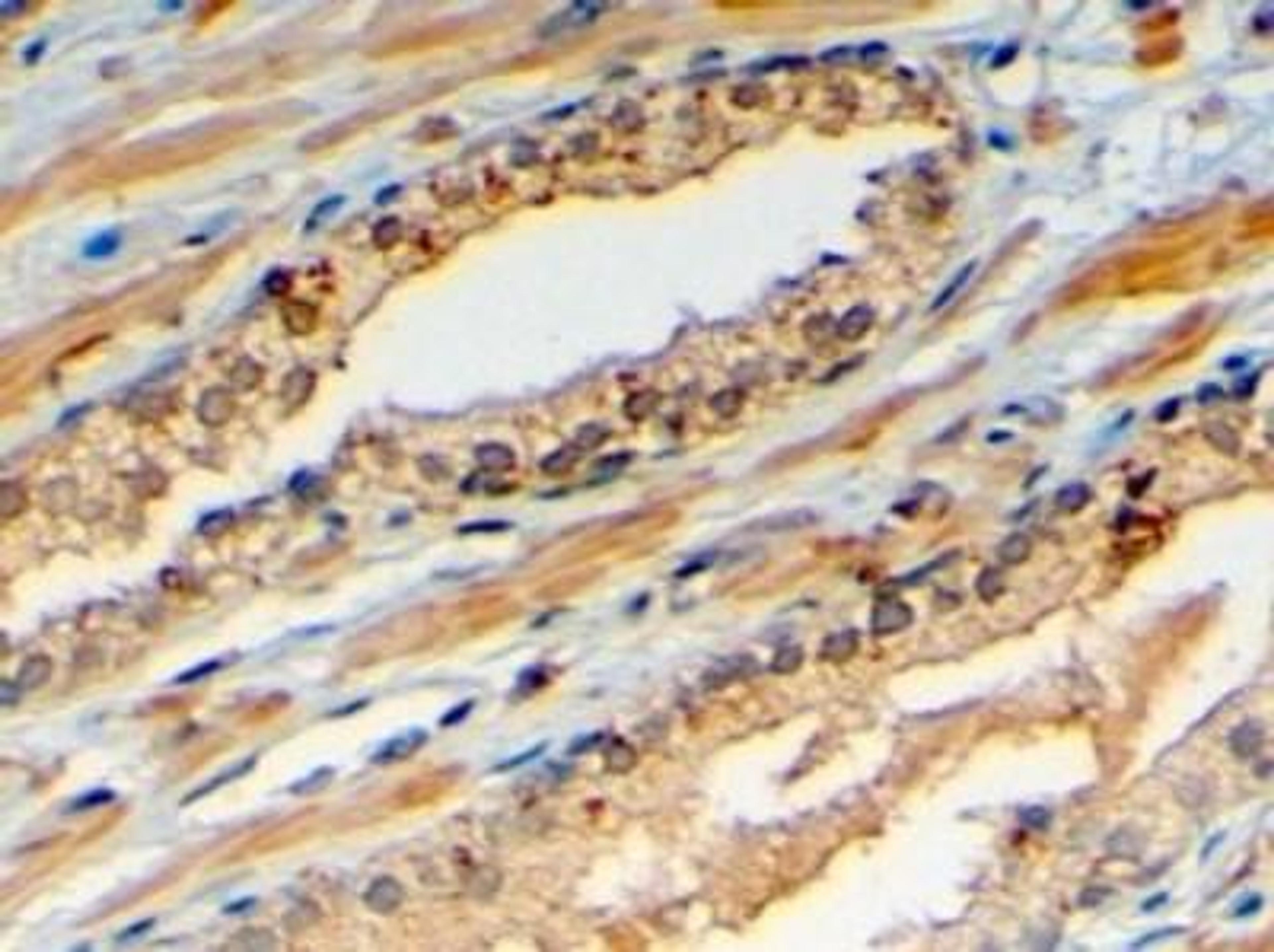 Immunohistochemistry-Paraffin: SRD5A1 Antibody [NB100-1491] - Staining of paraffin embedded Human Prostate. Steamed antigen retrieval with citrate buffer pH 6, HRP-staining.