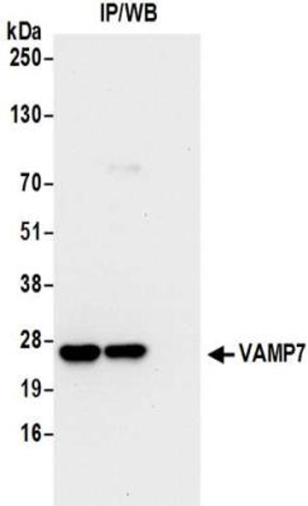 Immunoprecipitation: VAMP7 Antibody [NBP2-32232] - Samples:  Whole cell lysate (0.5 or 1.0 mg per IP reaction; 20% of IP loaded) from 293T cells. Antibodies:  Affinity purified rabbit anti-VAMP7 antibody NBP2-32232 used for IP at 6 ug per reaction.  VAMP7 was also immunoprecipitated by rabbit anti-VAMP7 antibody BL16273.  For blotting immunoprecipitated VAMP7, NBP2-32232 was used at 1 ug/ml.  Detection: Chemiluminescence with an exposure time of 10 seconds.