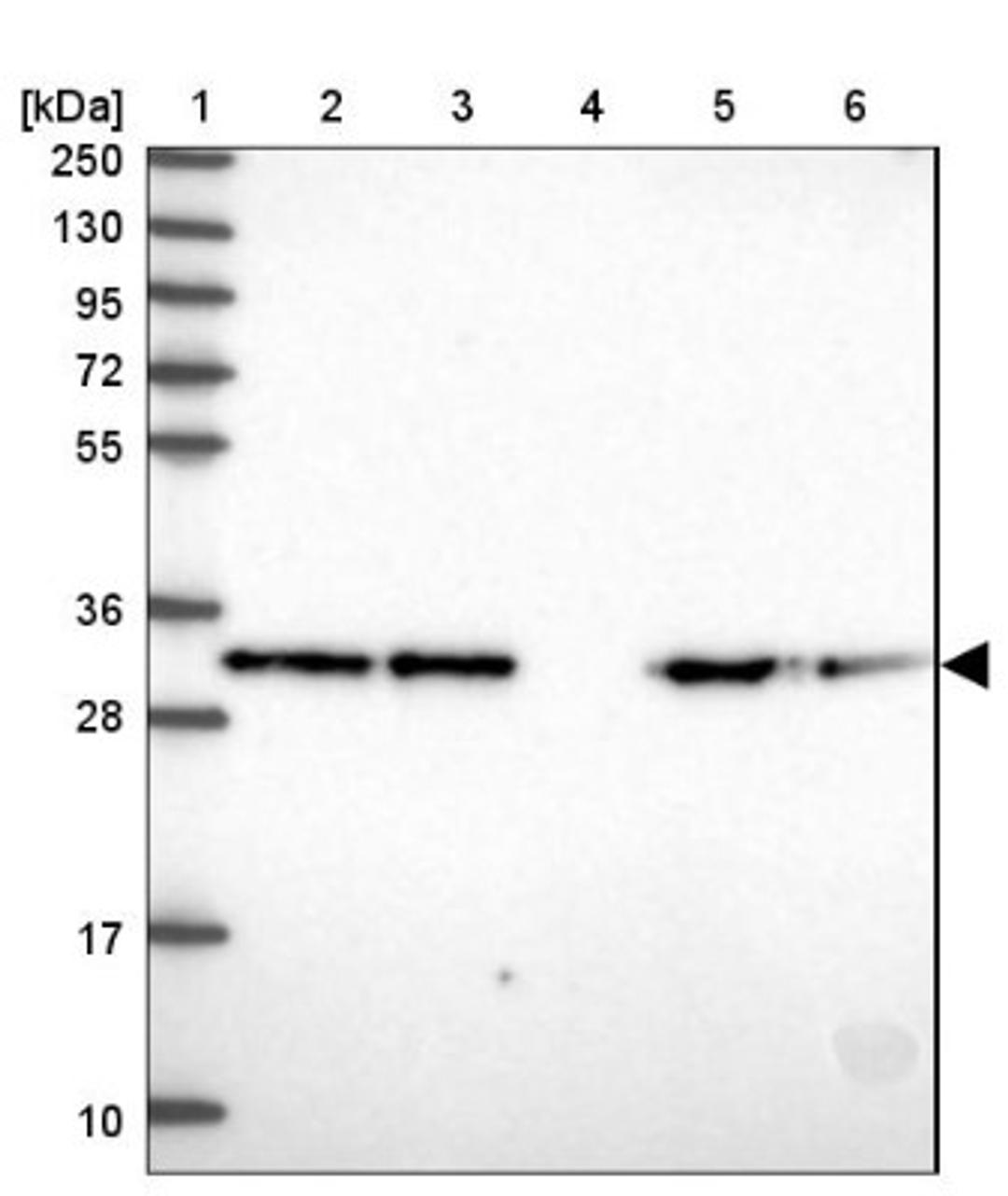 Western Blot: COPE Antibody [NBP2-38512] - Lane 1: Marker [kDa] 250, 130, 95, 72, 55, 36, 28, 17, 10<br/>Lane 2: RT-4<br/>Lane 3: U-251 MG<br/>Lane 4: Human Plasma<br/>Lane 5: Liver<br/>Lane 6: Tonsil