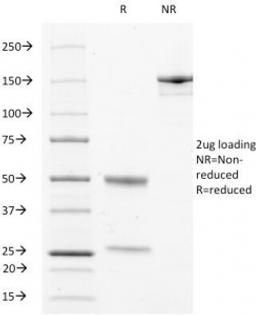 SDS-PAGE Analysis of Purified, BSA-Free LAMP3 Antibody (clone LAMP3/529). Confirmation of Integrity and Purity of the Antibody.