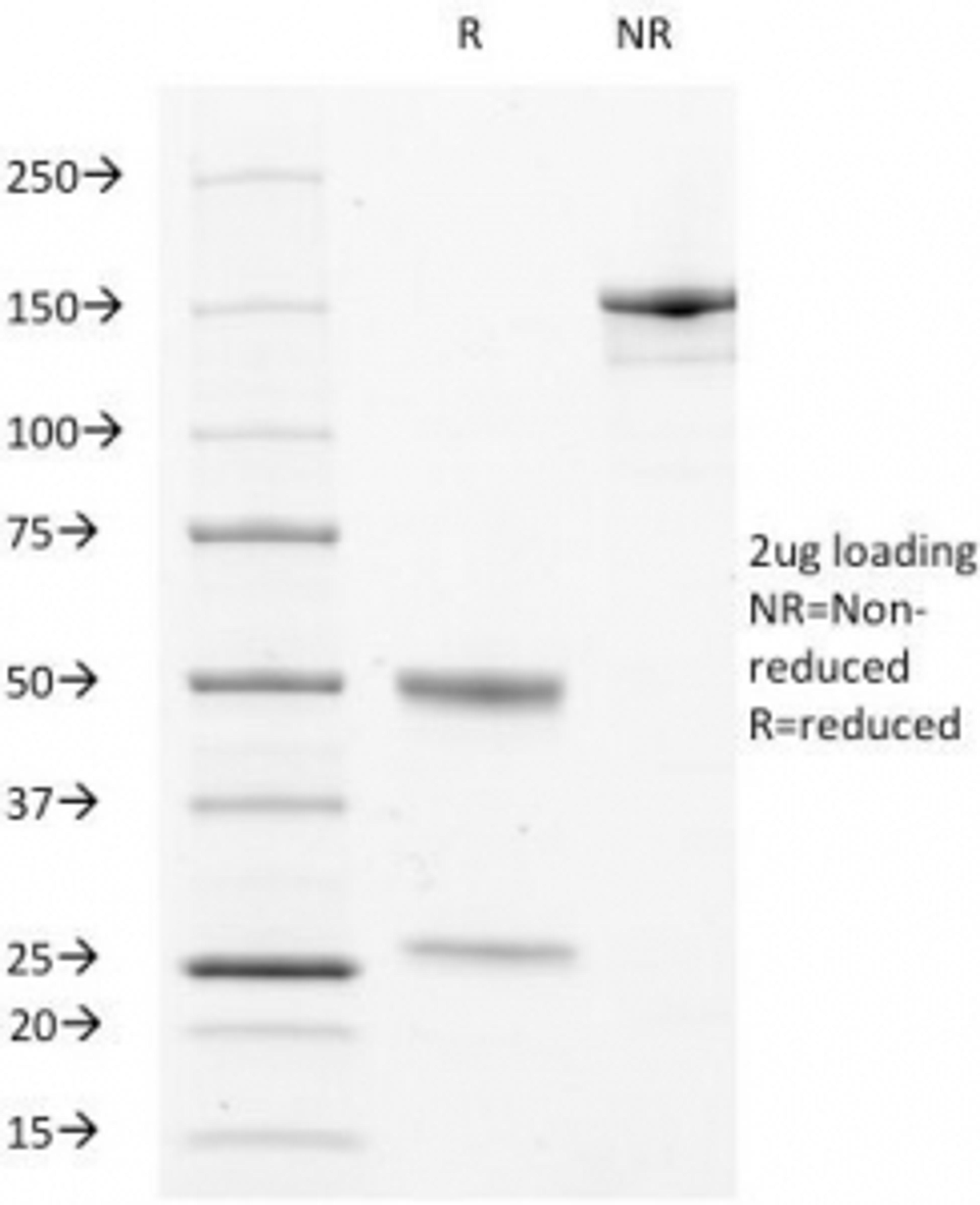 SDS-PAGE Analysis of Purified, BSA-Free LAMP3 Antibody (clone LAMP3/529). Confirmation of Integrity and Purity of the Antibody.