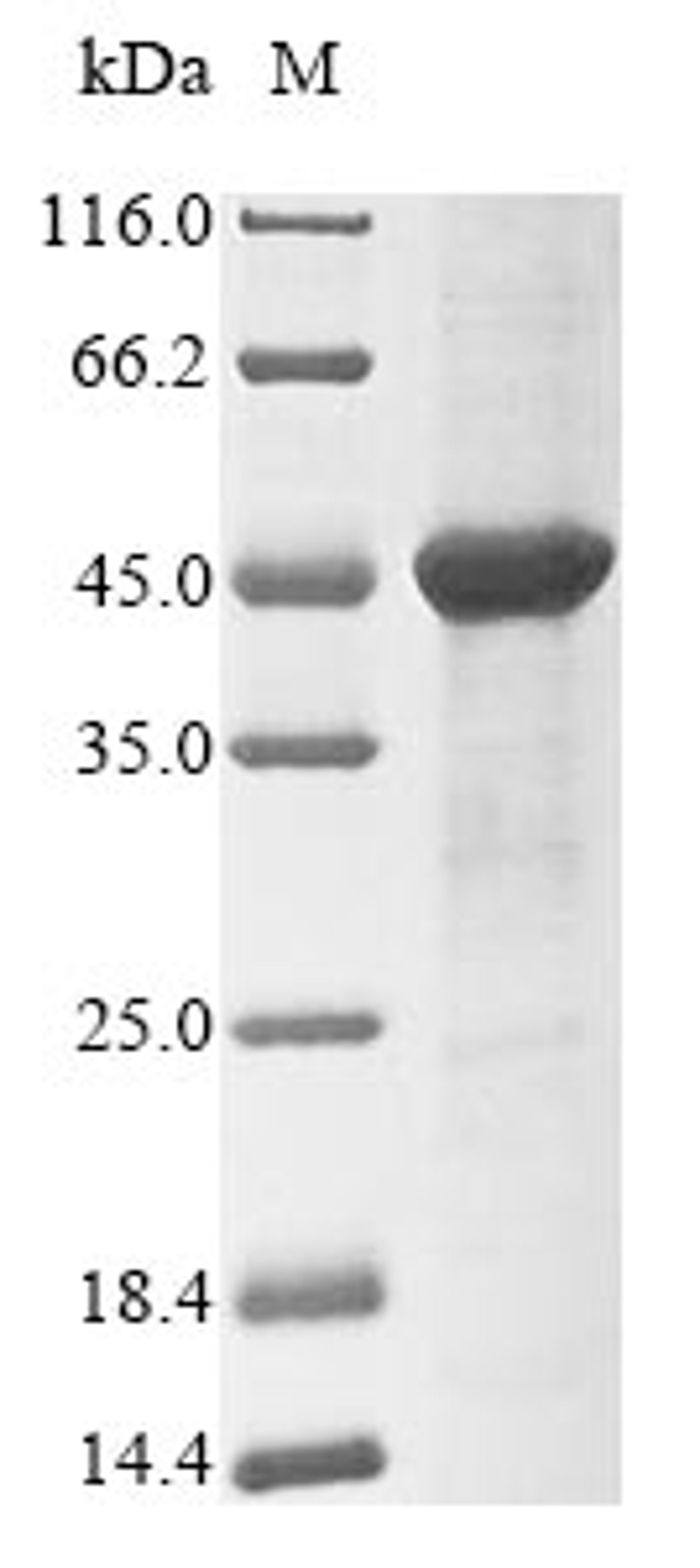 (Tris-Glycine gel) Discontinuous SDS-PAGE (reduced) with 5% enrichment gel and 15% separation gel.