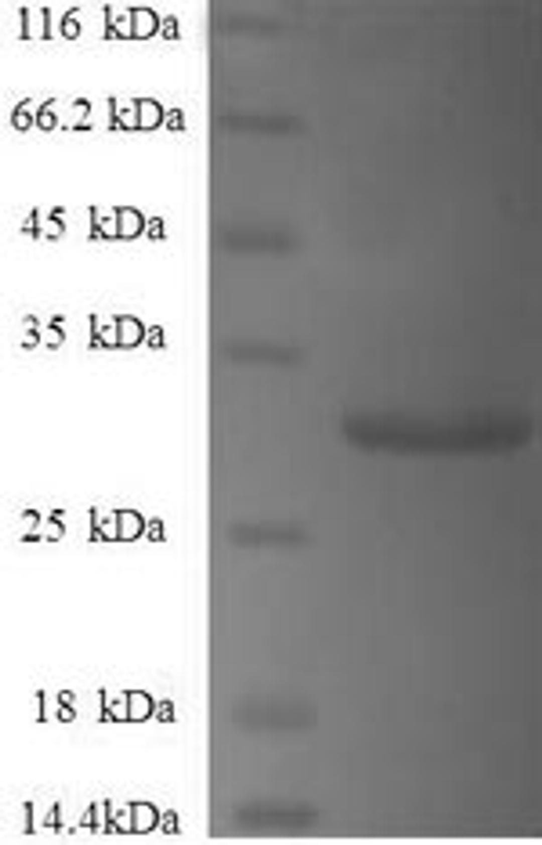 (Tris-Glycine gel) Discontinuous SDS-PAGE (reduced) with 5% enrichment gel and 15% separation gel.