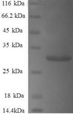(Tris-Glycine gel) Discontinuous SDS-PAGE (reduced) with 5% enrichment gel and 15% separation gel.