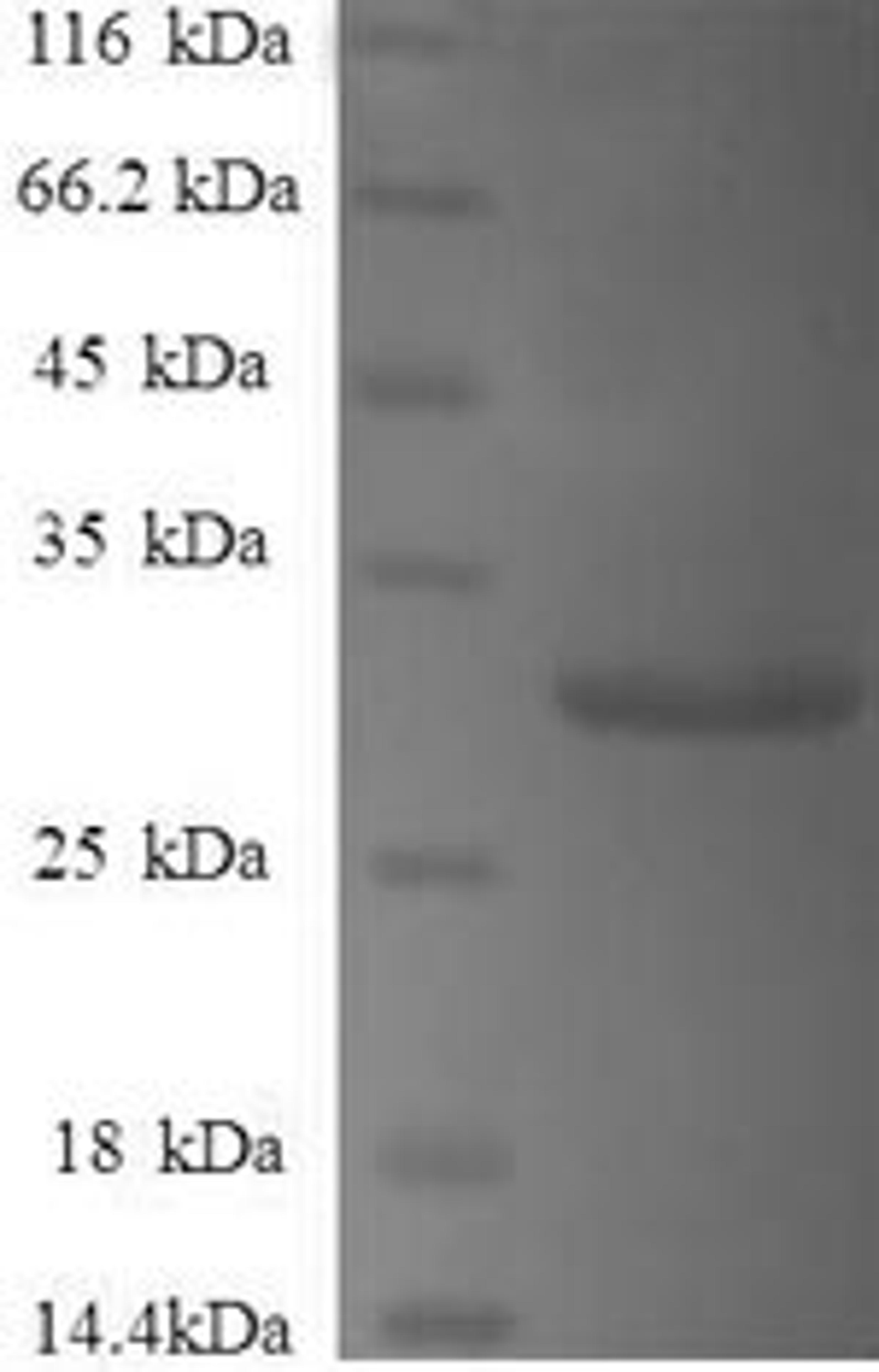 (Tris-Glycine gel) Discontinuous SDS-PAGE (reduced) with 5% enrichment gel and 15% separation gel.