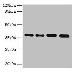 Western blot. All lanes: TMEM19 antibody at 1µg/ml. Lane 1: MCF-7 whole cell lysate. Lane 2: U251 whole cell lysate. Lane 3: Mouse stomach tissue. Lane 4: A549 whole cell lysate. Secondary. Goat polyclonal to rabbit IgG at 1/10000 dilution. Predicted band size: 37, 33 kDa. Observed band size: 37 kDa