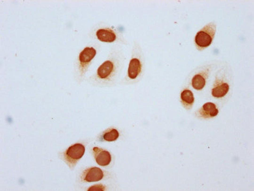 Immunocytochemistry analysis of CSB-PA010403OA85acHU diluted at 1:5 and staining in Hela cells (treated with 30mM sodium butyrate for 4h) performed on a Leica BondTM system. The cells were fixed in 4% formaldehyde, permeabilized using 0.2% Triton X-100 and blocked with 10% normal goat serum 30min at RT. Then primary antibody (1% BSA) was incubated at 4°C overnight. The primary is detected by a biotinylated secondary antibody and visualized using an HRP conjugated SP system.
