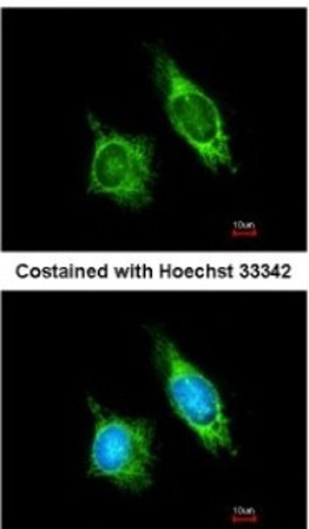 Immunocytochemistry/Immunofluorescence: AKAP1 Antibody [NBP2-15319] - Analysis of methanol-fixed HeLa, using antibody at 1:200 dilution.