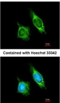 Immunocytochemistry/Immunofluorescence: AKAP1 Antibody [NBP2-15319] - Analysis of methanol-fixed HeLa, using antibody at 1:200 dilution.