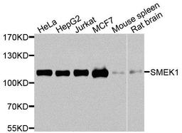 Western blot analysis of extracts of various cells using SMEK1 antibody