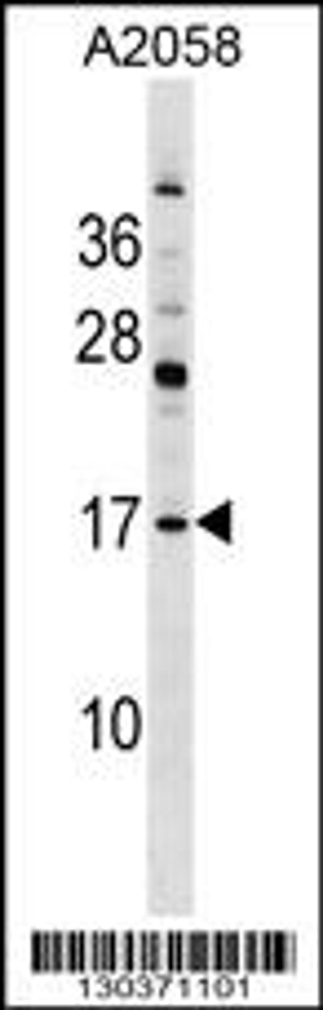 Western blot analysis in A2058 cell line lysates (35ug/lane).