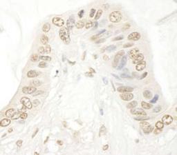 Detection of human SMG9 by immunohistochemistry.