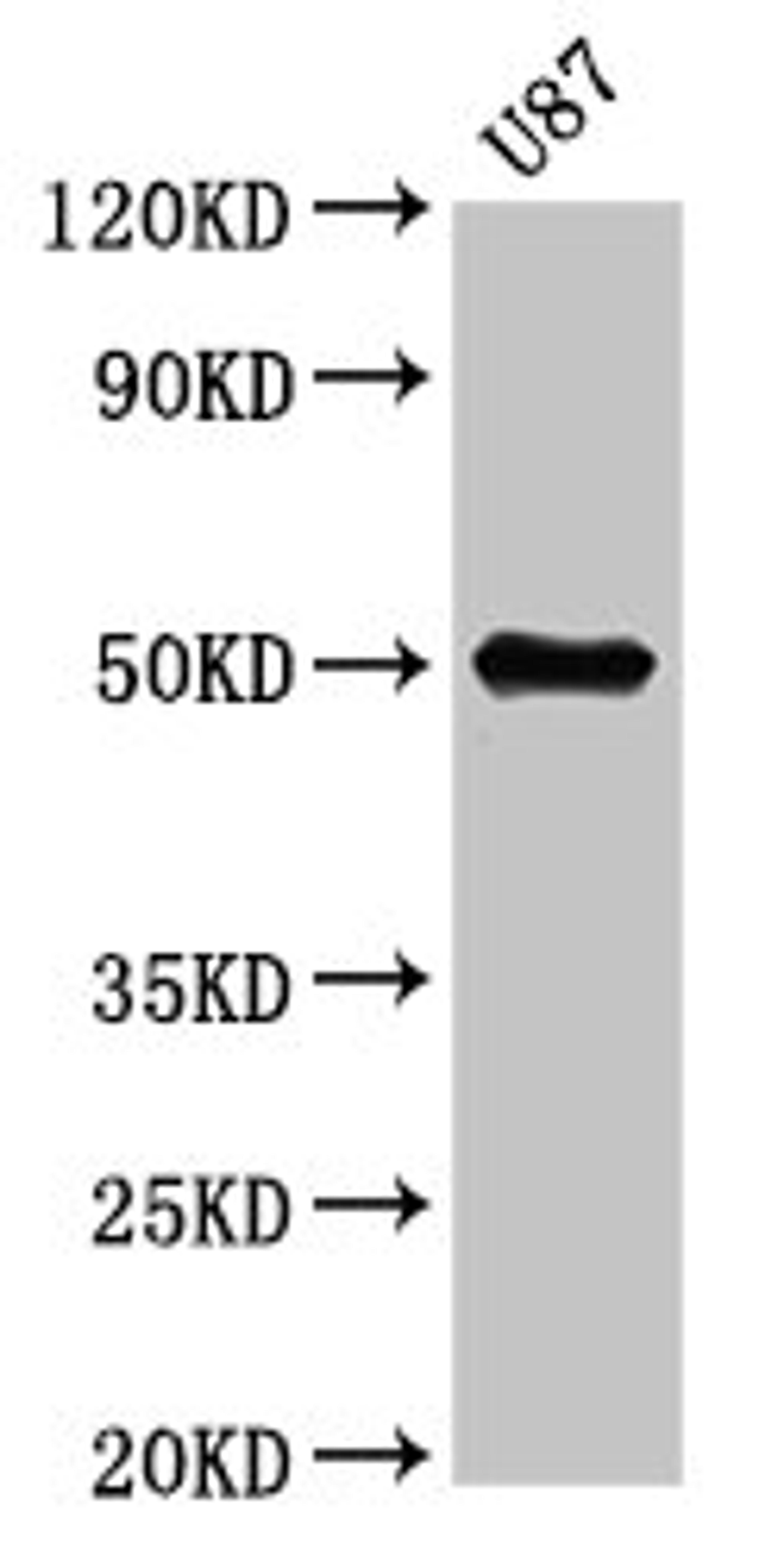 Western Blot. Positive WB detected in: U87 whole cell lysate. All lanes: URI1 antibody at 5.3µg/ml. Secondary. Goat polyclonal to rabbit IgG at 1/50000 dilution. Predicted band size: 60, 52, 57, 54 kDa. Observed band size: 52 kDa