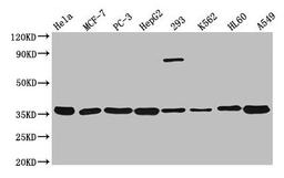 Western Blot. Positive WB detected in: Hela whole cell lysate, MCF-7 whole cell lysate, PC-3 whole cell lysate, HepG2 whole cell lysate, 293 whole cell lysate, K562 whole cell lysate, HL60 whole cell lysate, A549 whole cell lysate. All lanes: ANXA5 antibody at 1:3000. Secondary. Goat polyclonal to rabbit IgG at 1/50000 dilution. Predicted band size: 36 kDa. Observed band size: 36 kDa