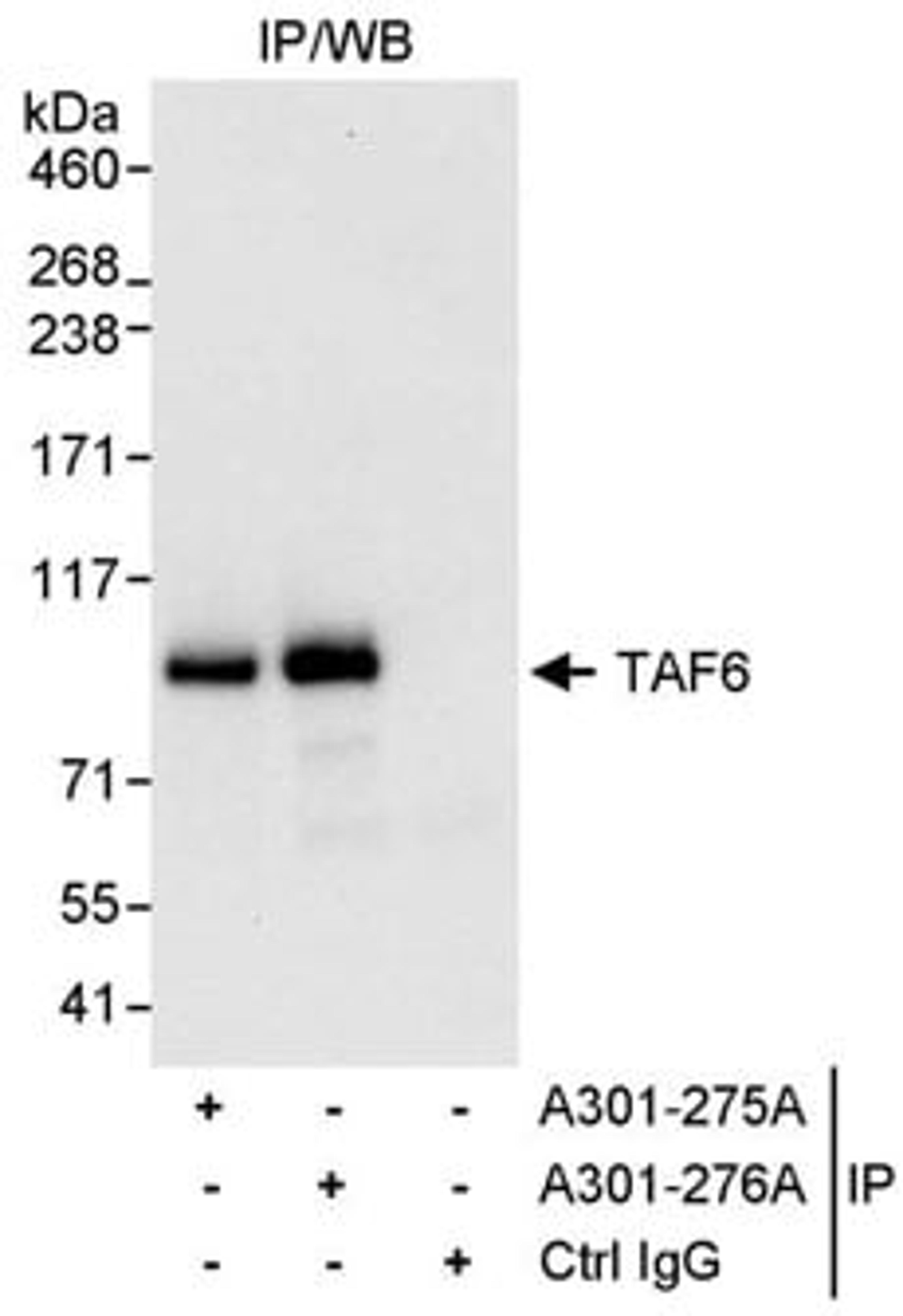 Detection of human TAF6 by western blot of immunoprecipitates.