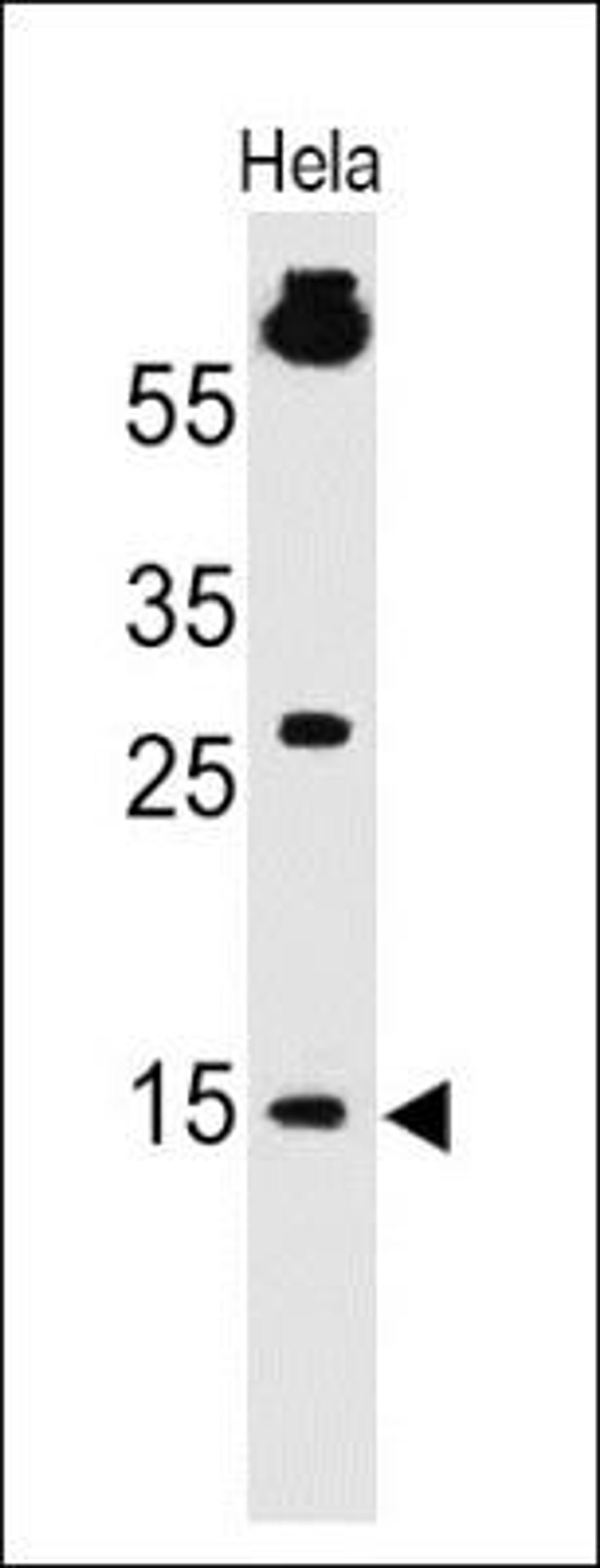 Western Blot: SUMO1 Antibody (SM1/495) [NBP2-32901] - Analysis using the Azide and BSA Free version of NBP2-32901. Detection of SUMO1 in human HeLa Cell lysate.