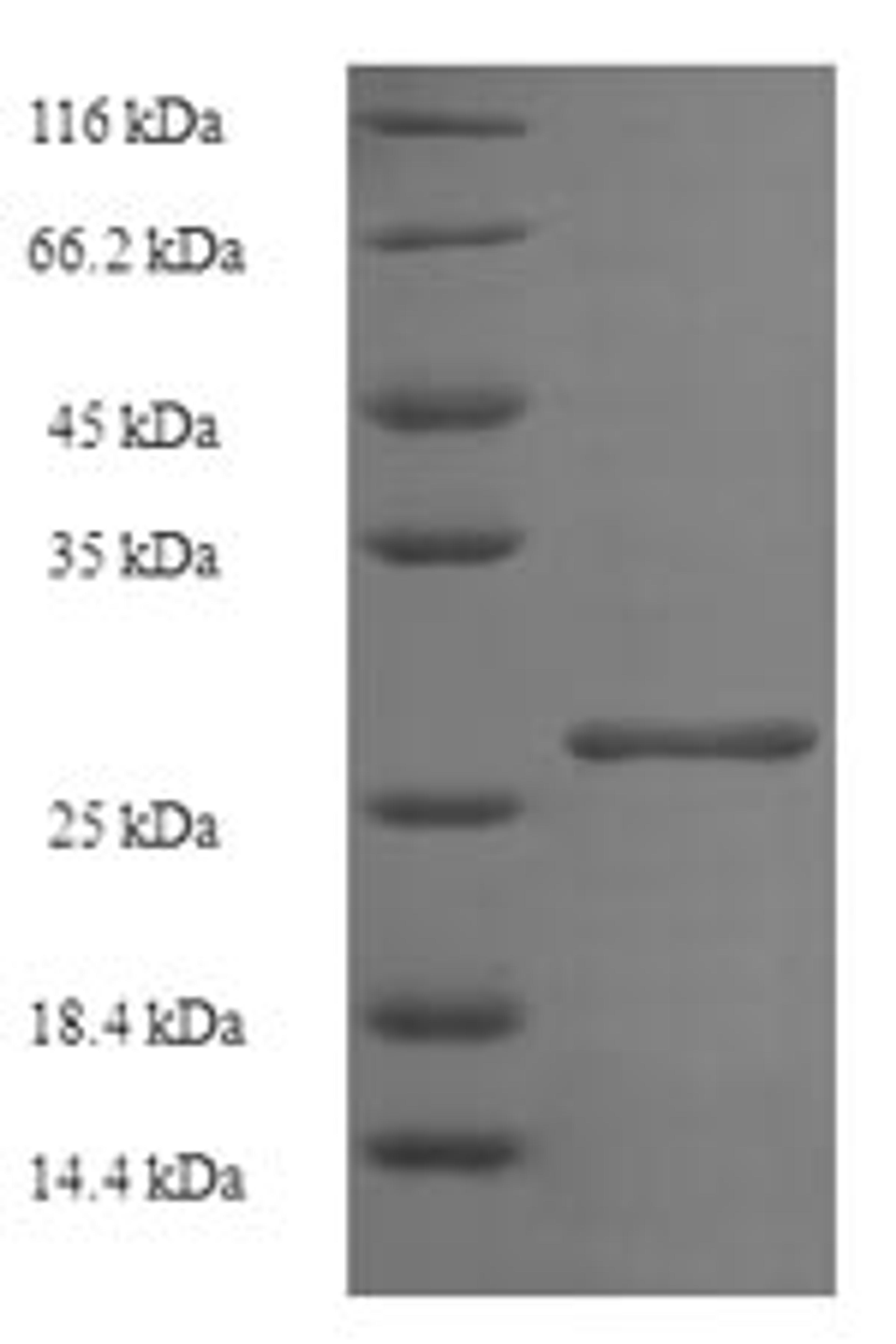 (Tris-Glycine gel) Discontinuous SDS-PAGE (reduced) with 5% enrichment gel and 15% separation gel.
