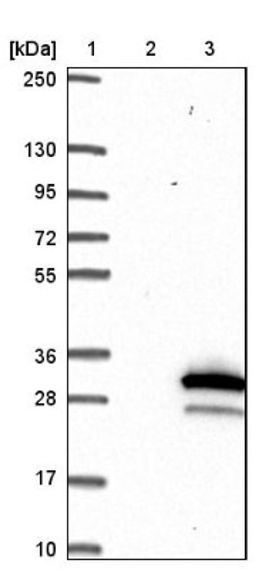 Western Blot: Synaptobrevin homolog YKT6 Antibody [NBP1-90344] - Lane 1: Marker [kDa] 250, 130, 95, 72, 55, 36, 28, 17, 10<br/>Lane 2: Negative control (vector only transfected HEK293T lysate)<br/>Lane 3: Over-expression lysate (Co-expressed with a C-terminal myc-DDK tag (~3.1 kDa) in mammalian HEK293T cells, LY416570)