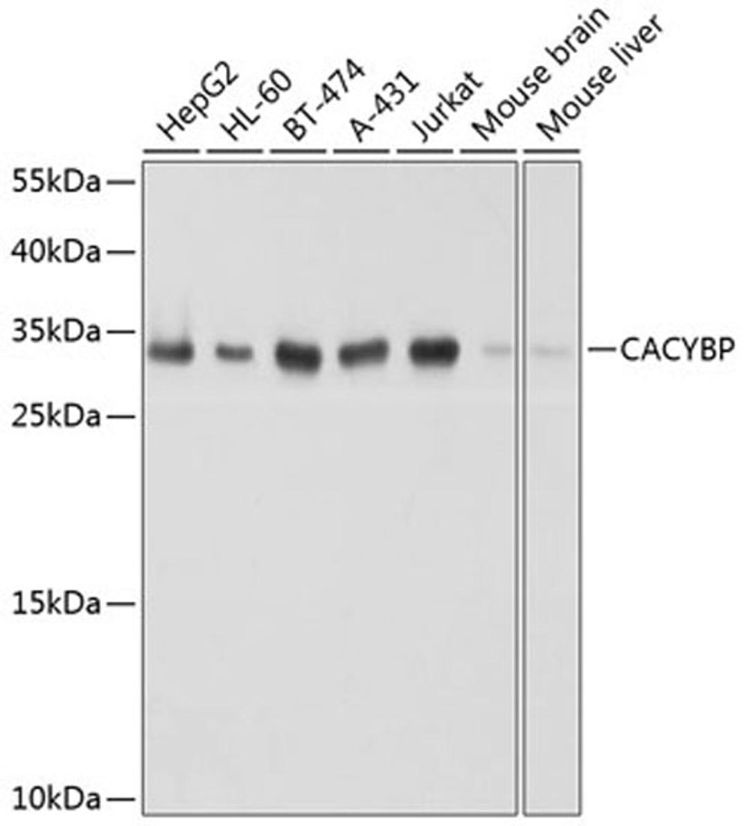 Western blot - CACYBP antibody (A8757)