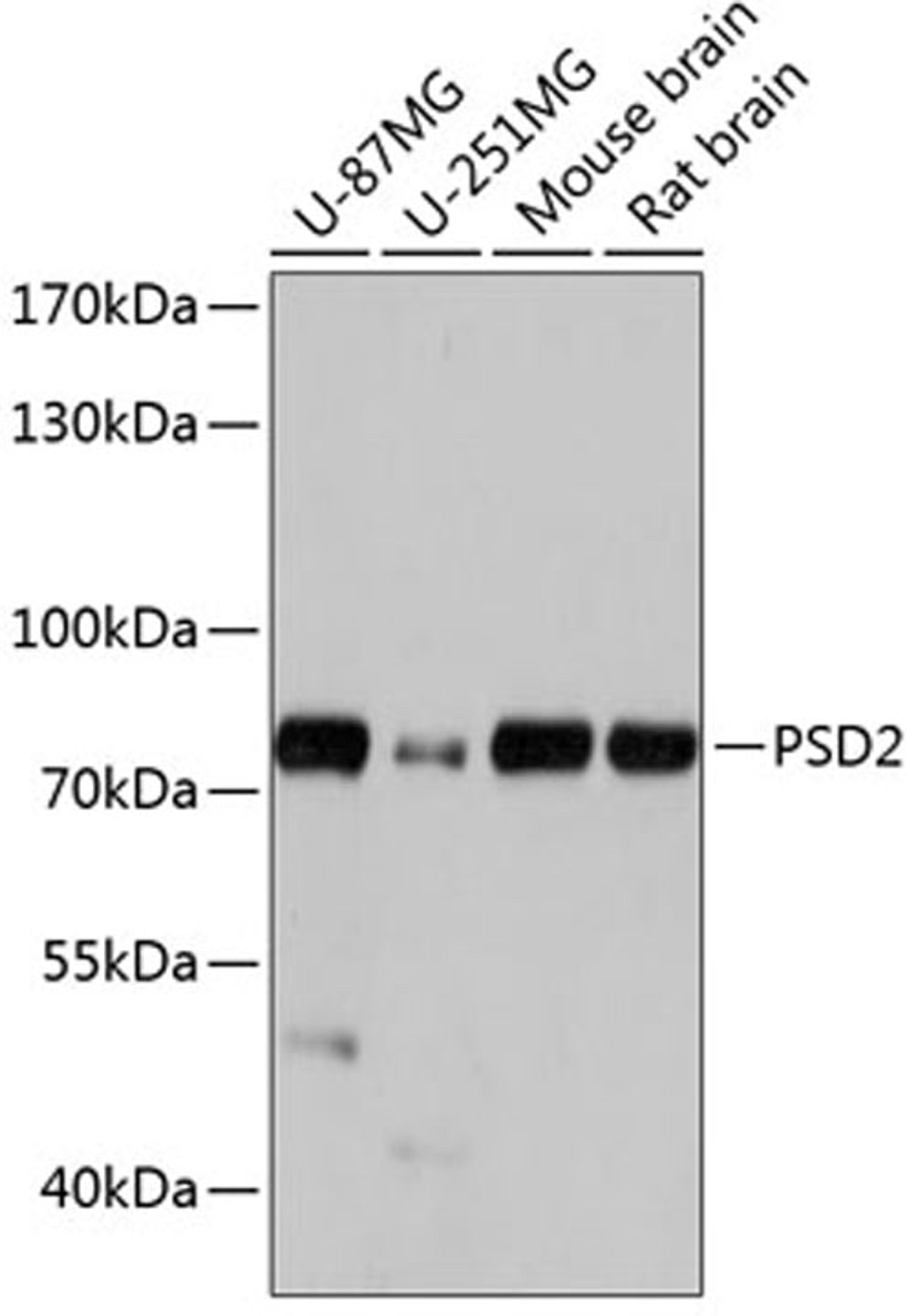 Western blot - PSD2 antibody (A14429)