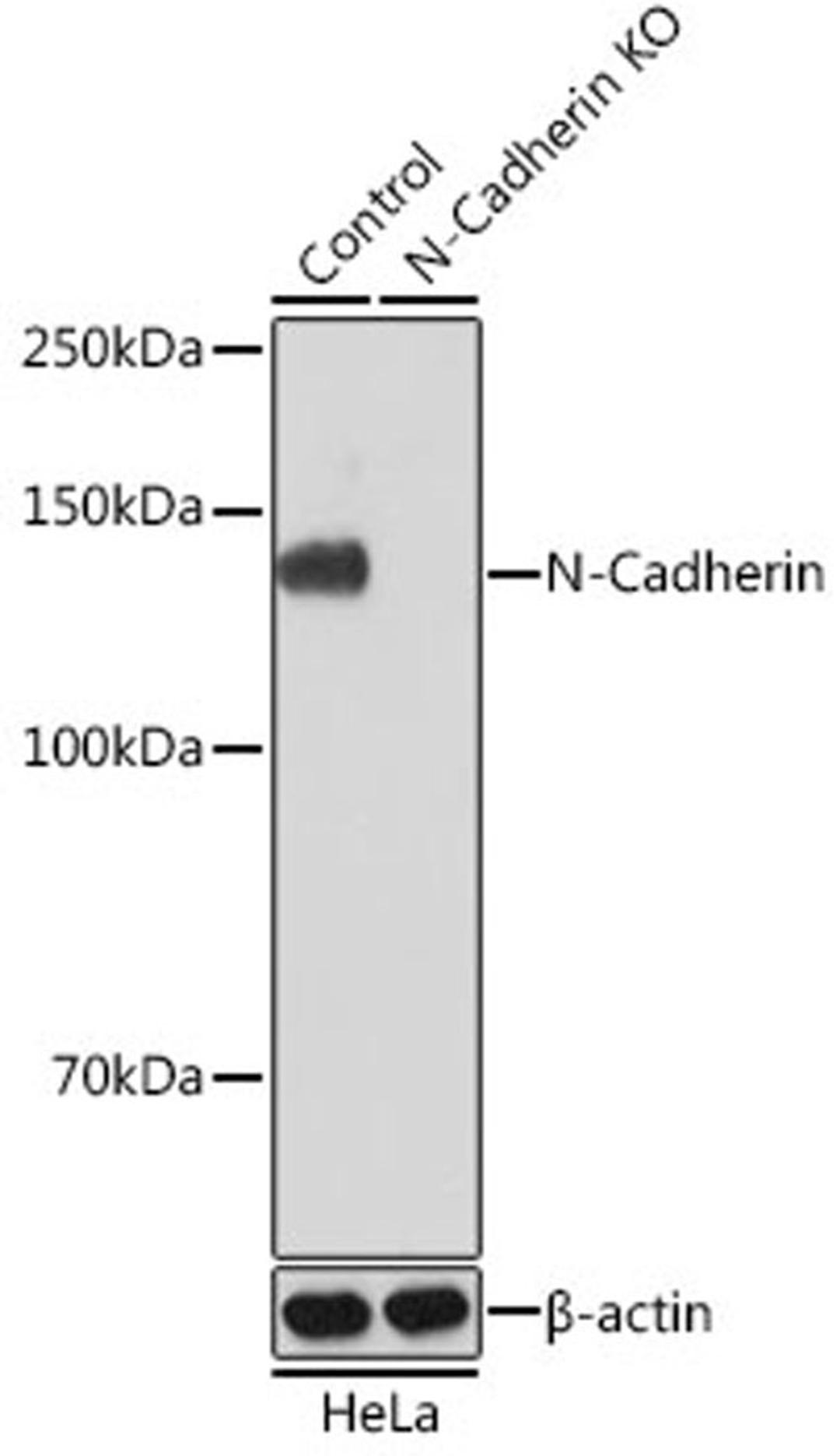 Western blot - N-Cadherin antibody (A19083)