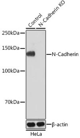 Western blot - N-Cadherin antibody (A19083)