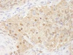 Detection of mouse WDR77/MEP50 by immunohistochemistry.