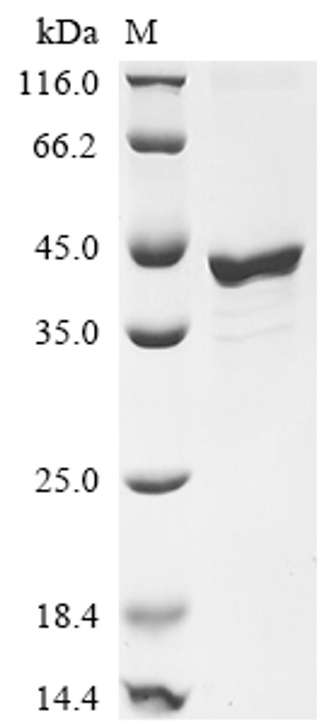 (Tris-Glycine gel) Discontinuous SDS-PAGE (reduced) with 5% enrichment gel and 15% separation gel.