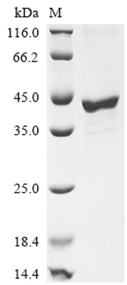 (Tris-Glycine gel) Discontinuous SDS-PAGE (reduced) with 5% enrichment gel and 15% separation gel.