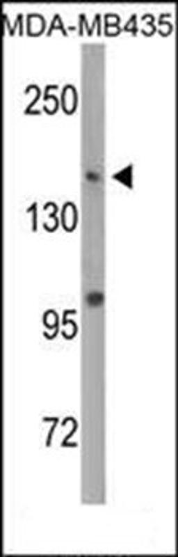 Western blot analysis of MDA-MB435 cell line lysates (35ug/lane) using DNMT1 antibody (S1105)