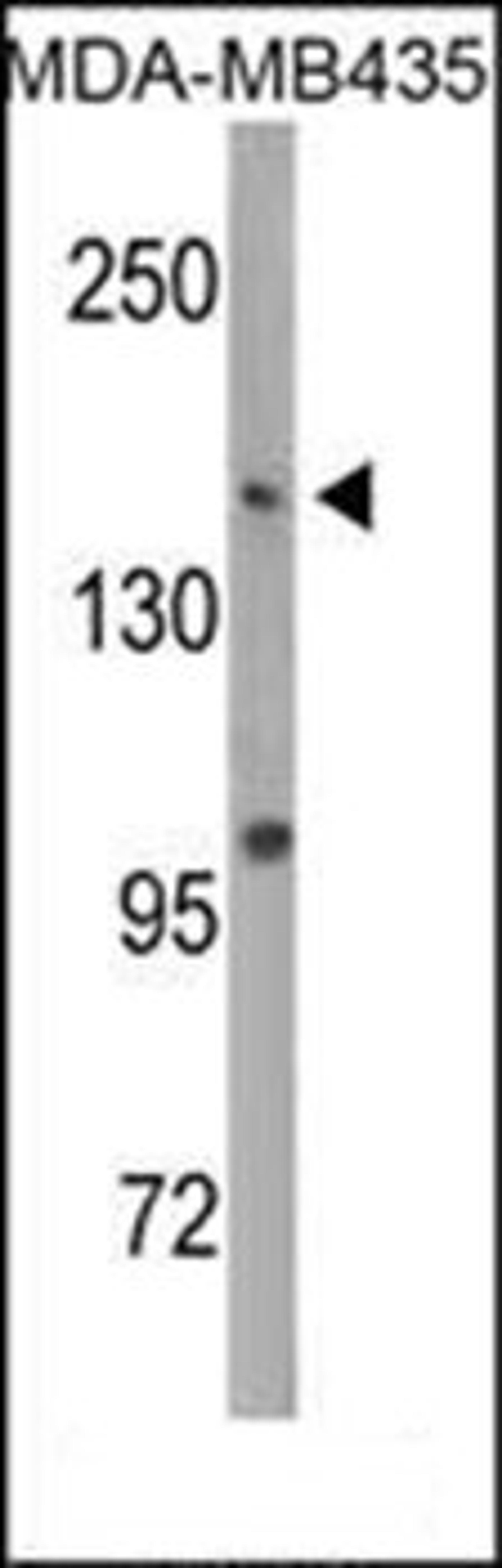 Western blot analysis of MDA-MB435 cell line lysates (35ug/lane) using DNMT1 antibody (S1105)