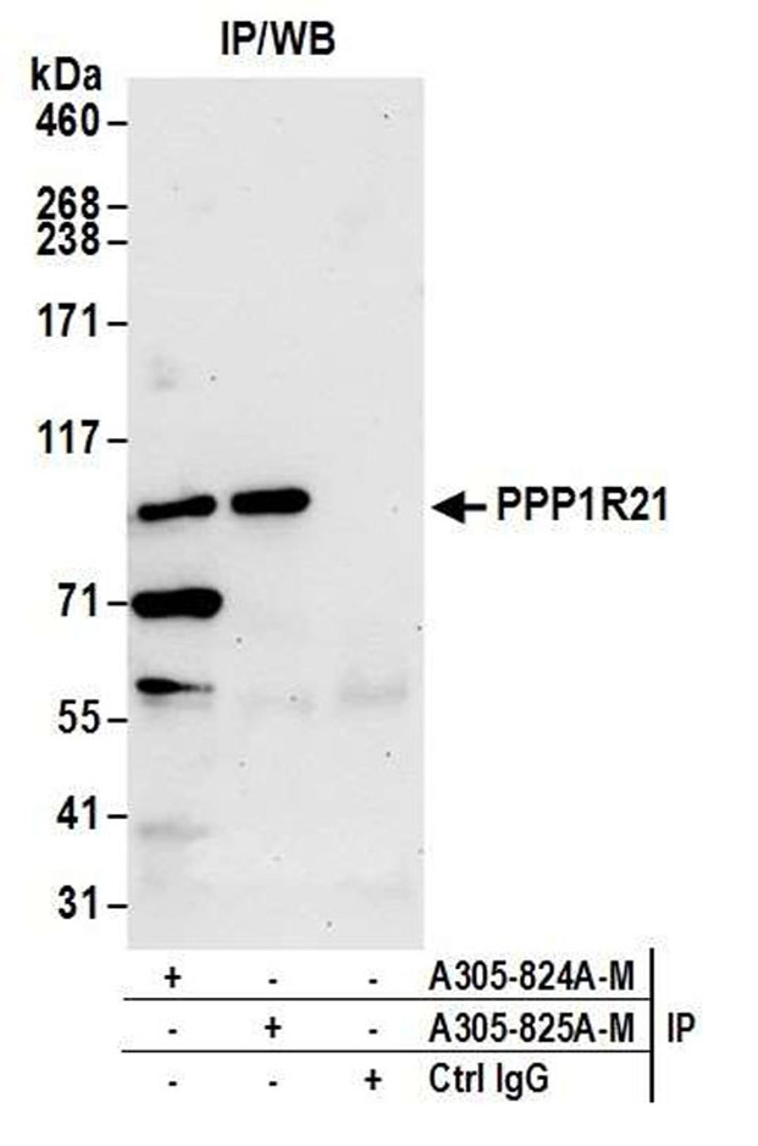 Detection of human PPP1R21 by WB of IP.