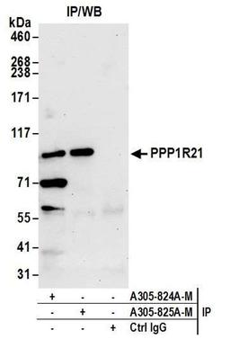 Detection of human PPP1R21 by WB of IP.